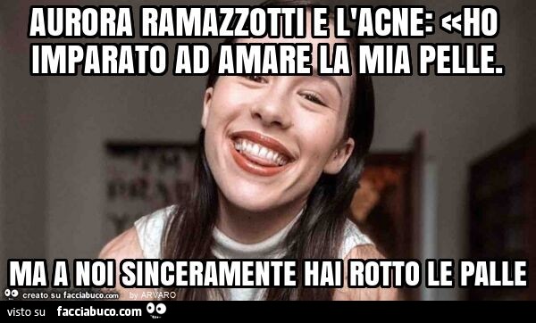 Aurora ramazzotti e l'acne: «ho imparato ad amare la mia pelle. Ma a noi sinceramente hai rotto le palle