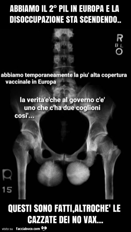 Due palle così