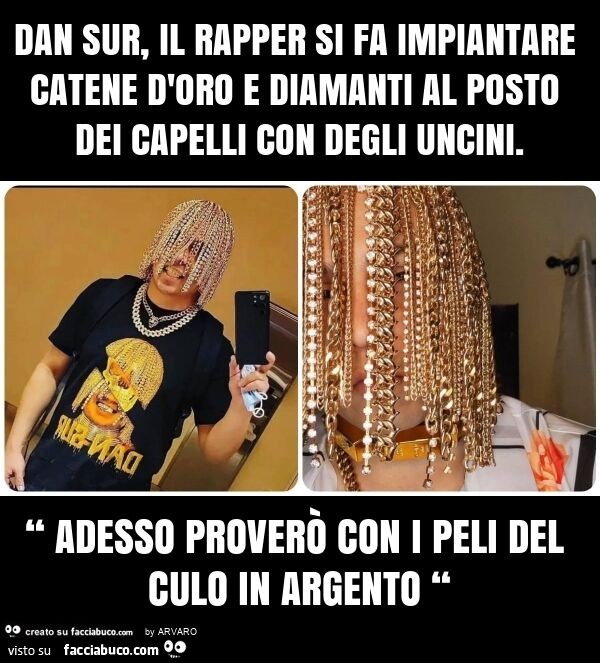Dan sur, il rapper si fa impiantare catene d'oro e diamanti al posto dei capelli con degli uncini. “ Adesso proverò con i peli del culo in argento “