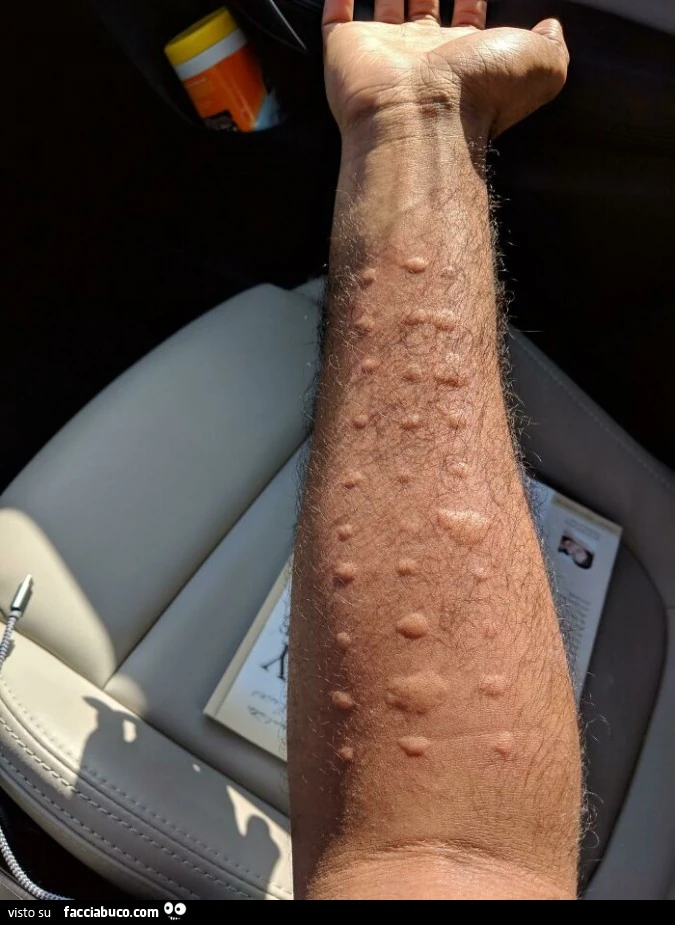 Vaccata