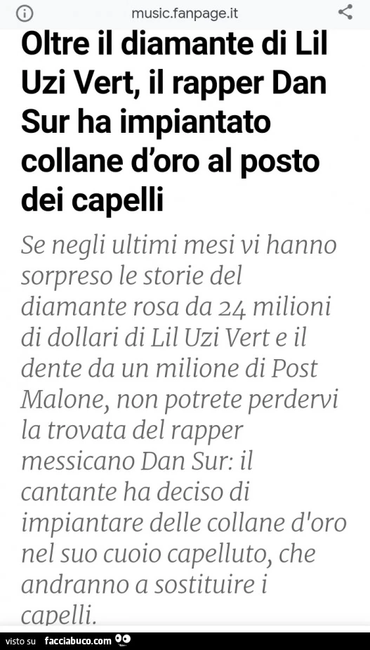 Oltre il diamante di lil uzi vert, il rapper dan sur ha impiantato collane d'oro al posto dei capelli