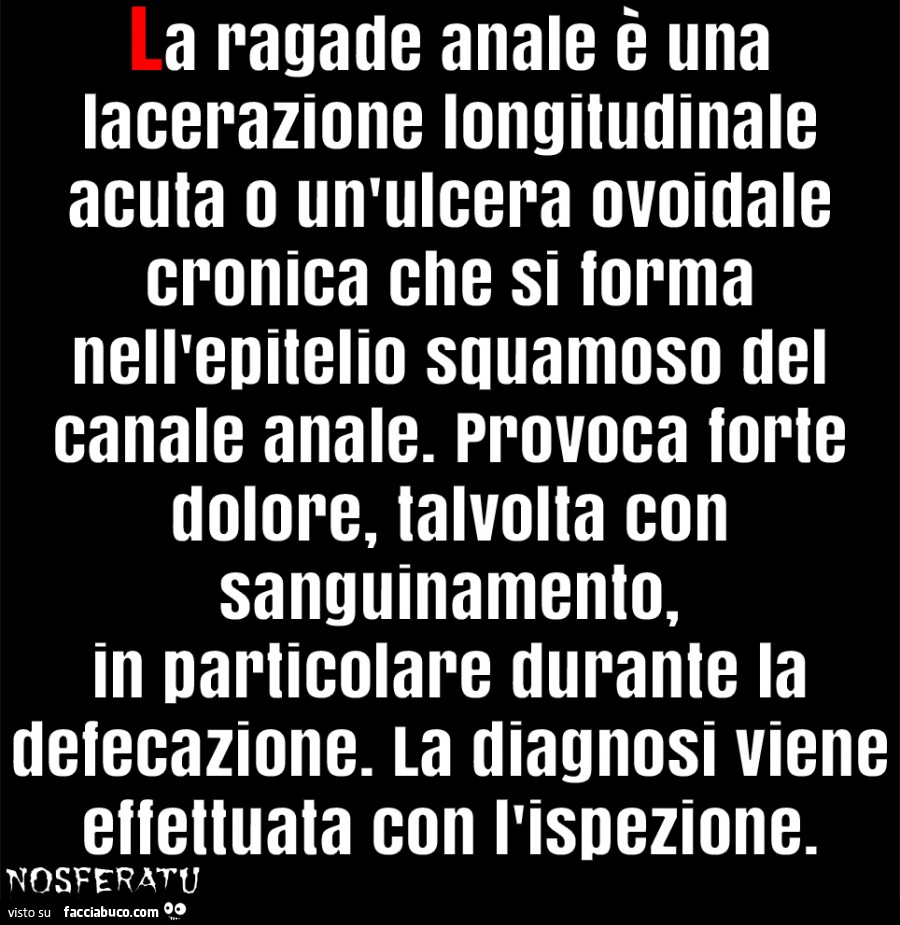 SE NON SAI LE COSE… SALLE