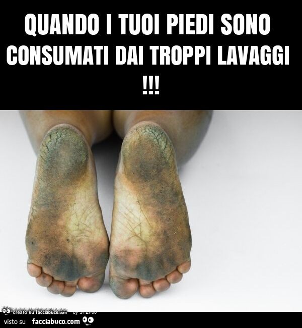 Quando i tuoi piedi sono consumati dai troppi lavaggi